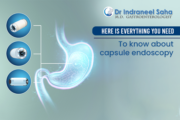 Here is everything you need to know about capsule endoscopy