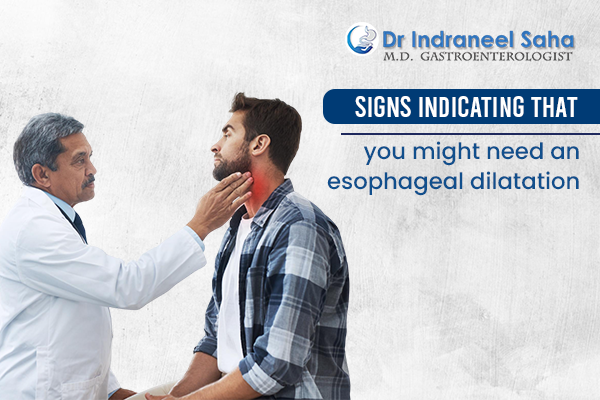 Signs indicating that you might need an esophageal dilatation