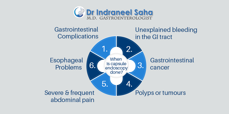 When Is Capsule Endoscopy Done?