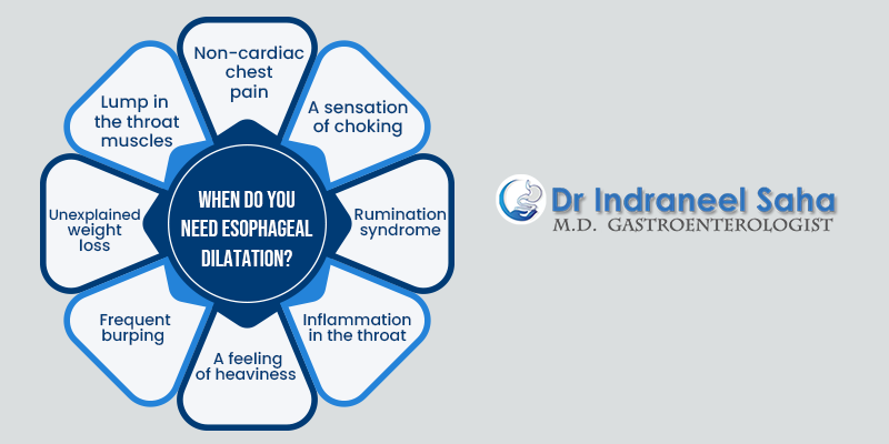 When do you need esophageal dilatation?  