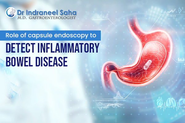 Role of capsule endoscopy to detect inflammatory bowel disease