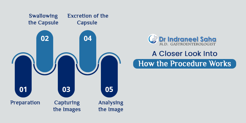 A closer look into how the procedure works