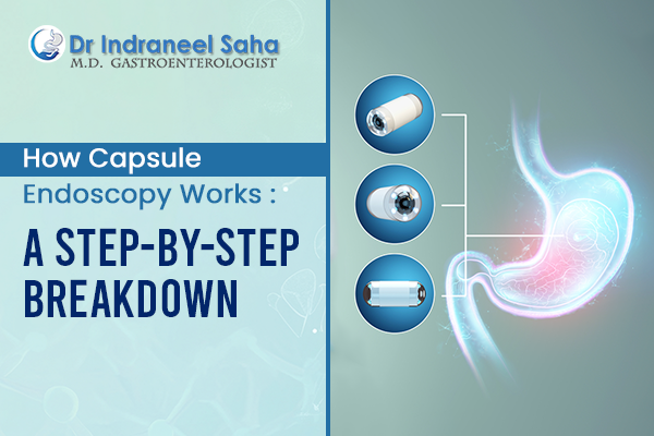 How capsule endoscopy works A step-by-step breakdown