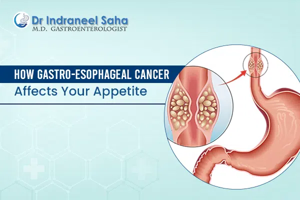 How gastro-esophageal cancer affects your appetite