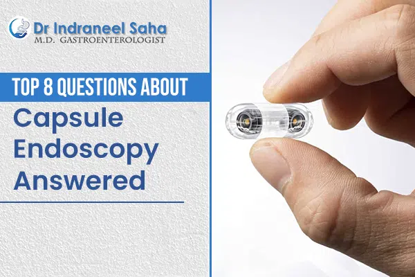 Top 8 questions about capsule endoscopy answered