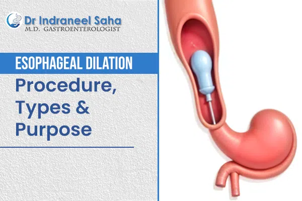 Esophageal Dilation