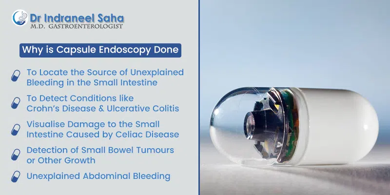 Why is capsule endoscopy done