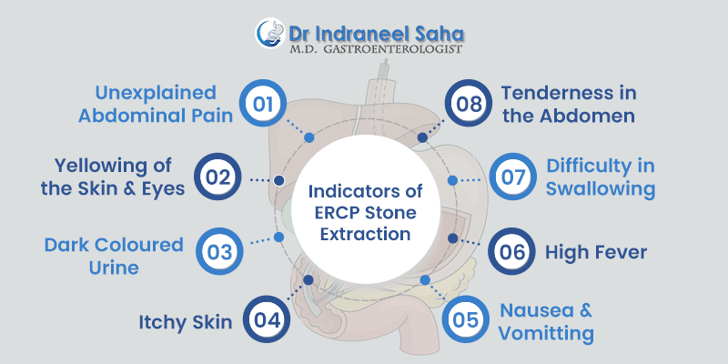 indicators of ercp stone extraction