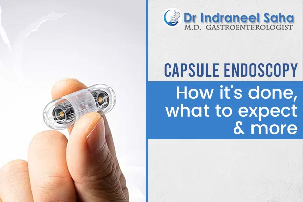 capsule endoscopy