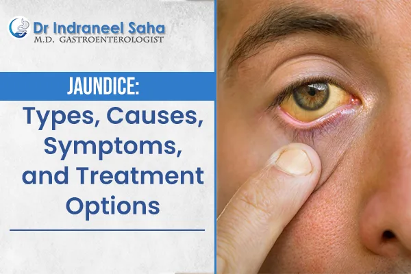 Jaundice treatment