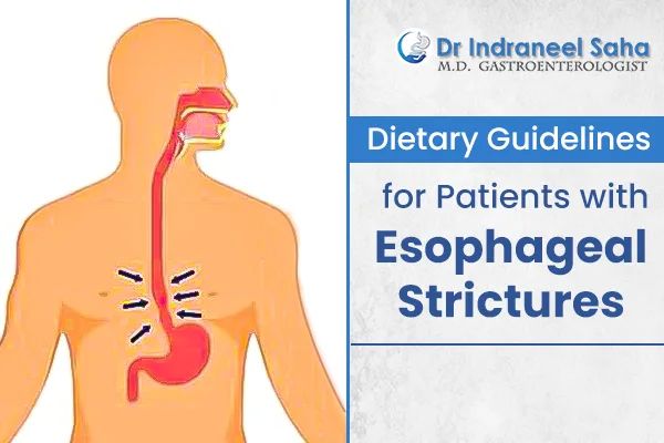 esophageal dilatation
