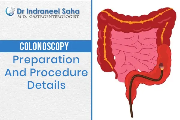 colonoscopy doctor