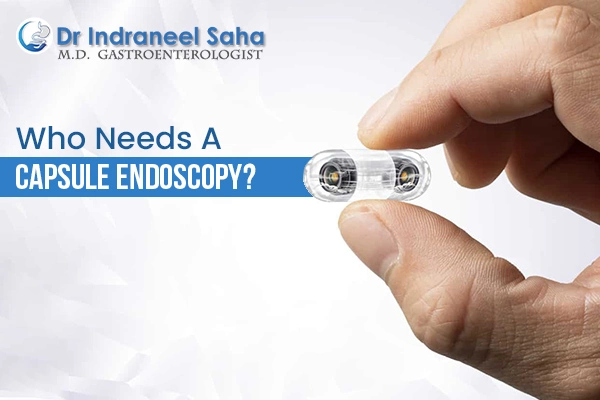 capsule endoscopy