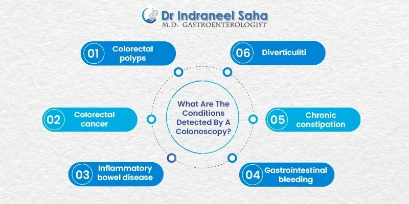 colonoscopy doctor