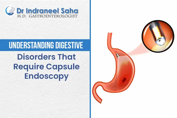 capsule endoscopy
