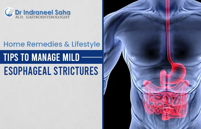 esophageal dilatation