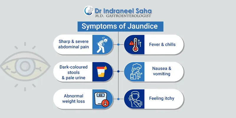 jaundice treatment doctor