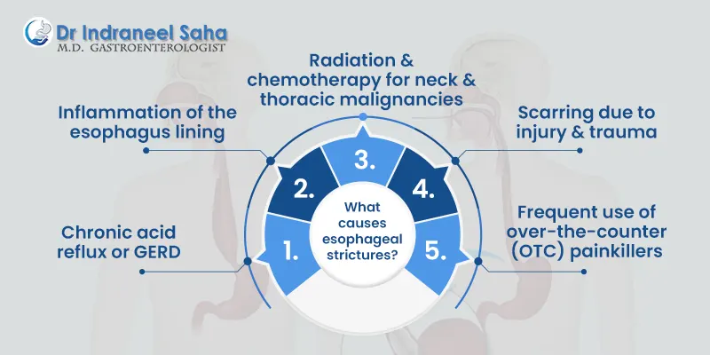 esophageal dilatation