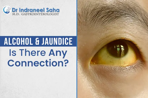 doctor for jaundice