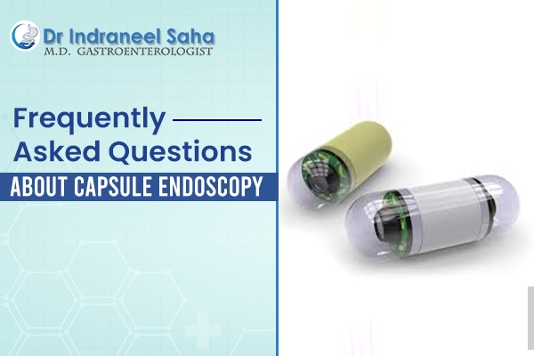 Capsule endoscopy