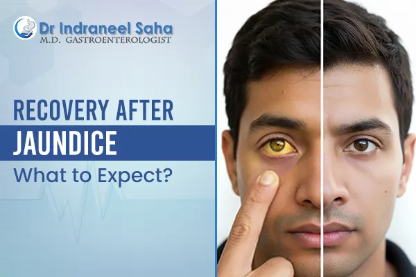 doctor for jaundice