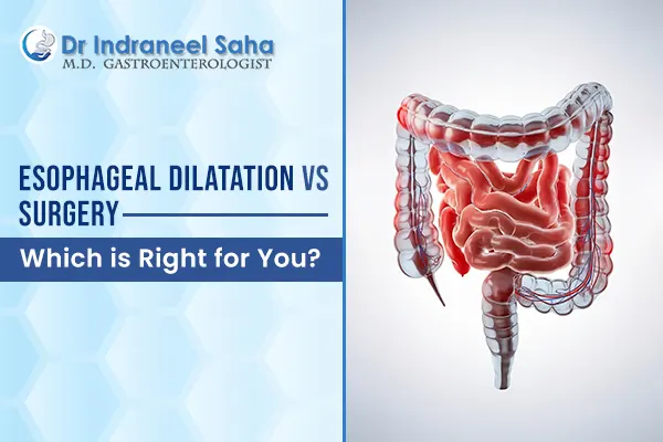 esophageal dilatation