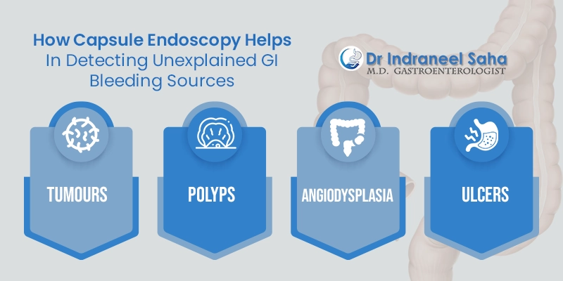 capsule endoscopy