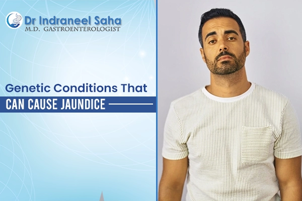 doctor for jaundice