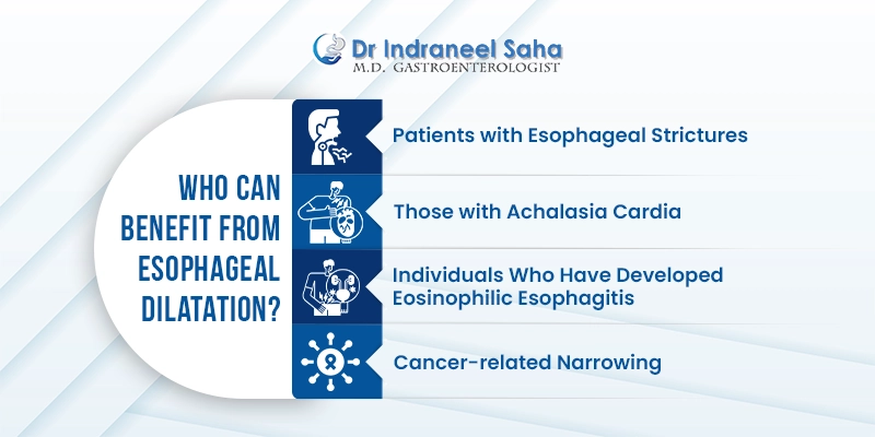 esophageal dilatation
