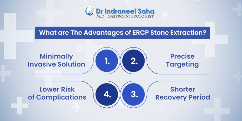 ERCP stone extraction