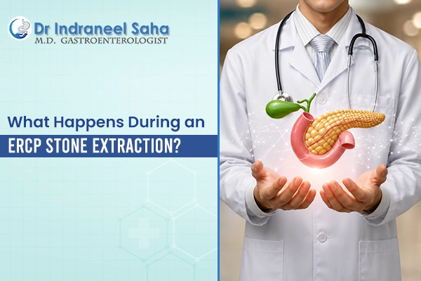 ERCP stone extraction