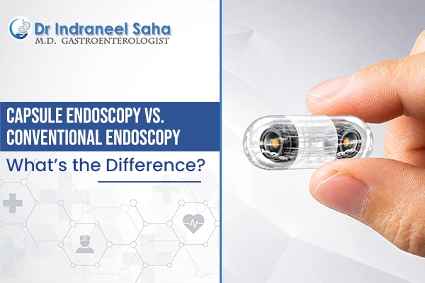 Capsule Endoscopy