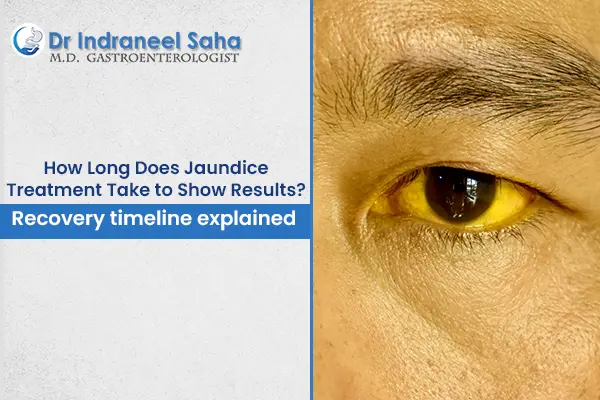 jaundice treatment doctor