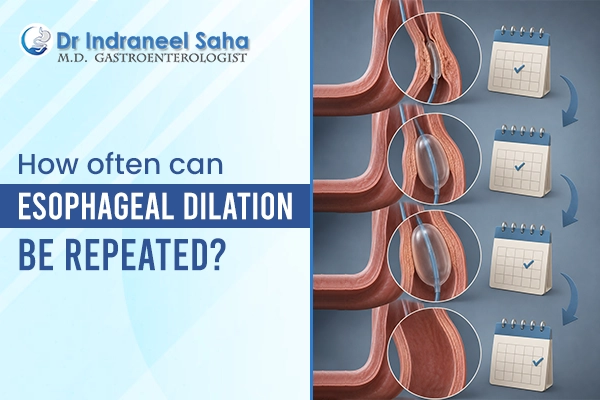 Esophageal Dilation