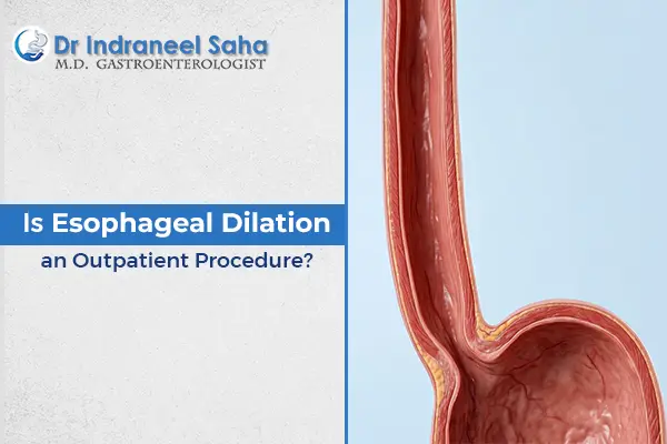 Esophageal Dilation