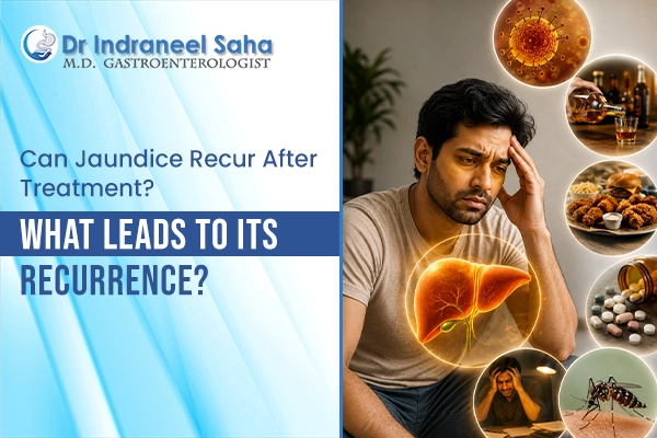Doctor For Jaundice