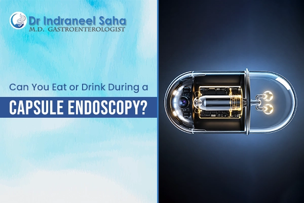 Capsule Endoscopy